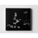 画像1: Warble: Brad Henkel / Miako Klein "Swarm" [CD] (1)