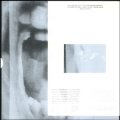 Takashi Inagaki "Prisoner of Love: The Dead Dance" [LP]